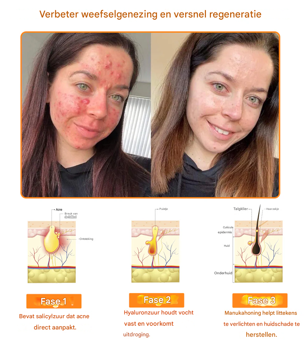 LS | 7-Daagse Bijengif Huidbehandeling 1+1 gratis