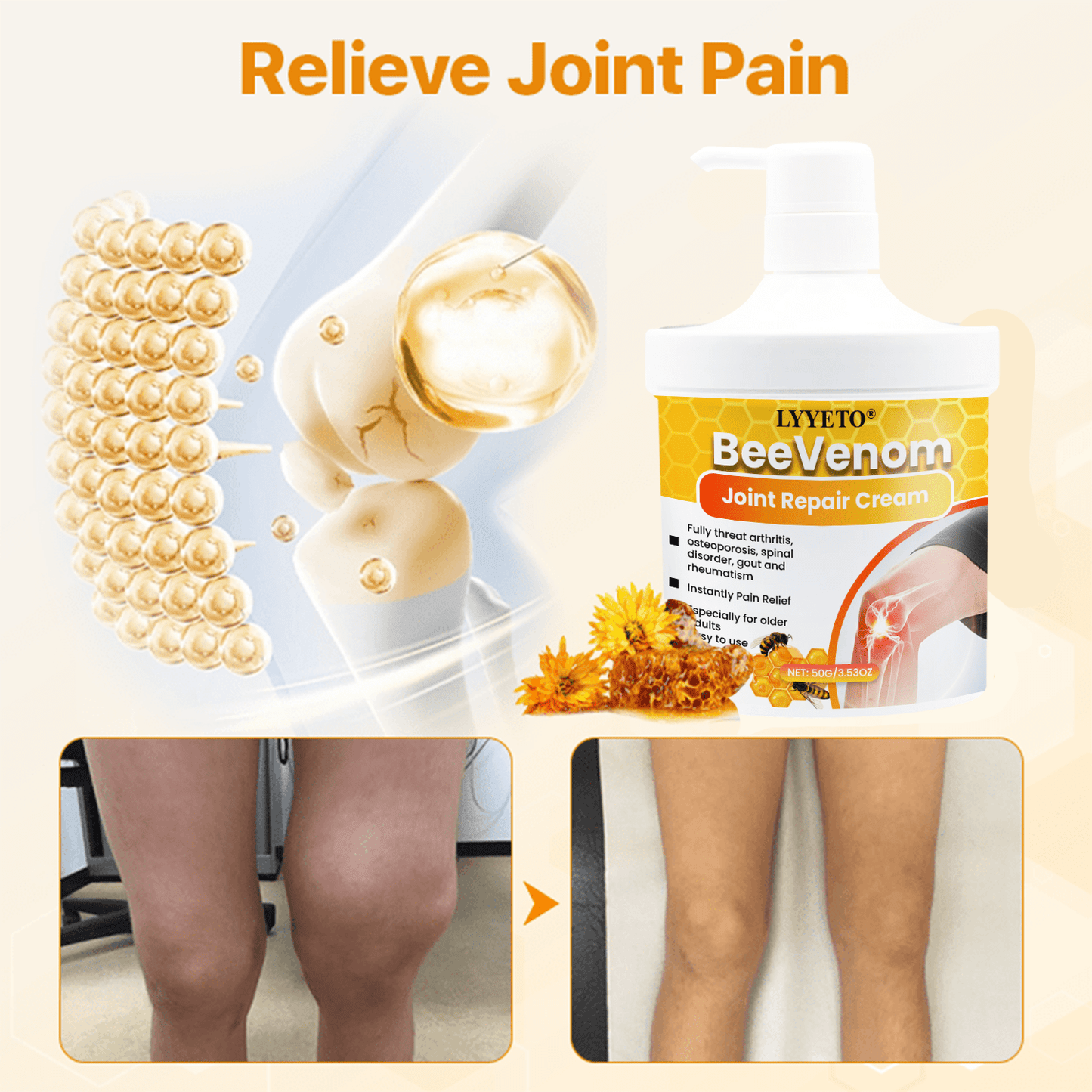 LS | Gewrichtherstel