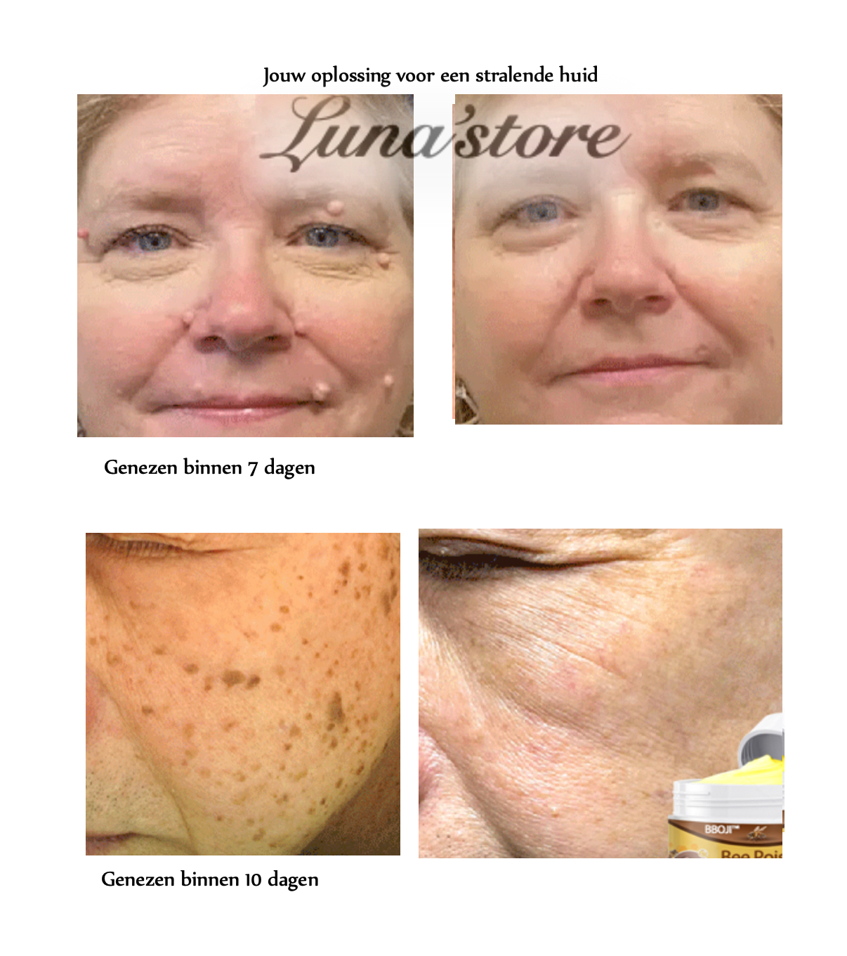 LS | Bijengif huid behandeling