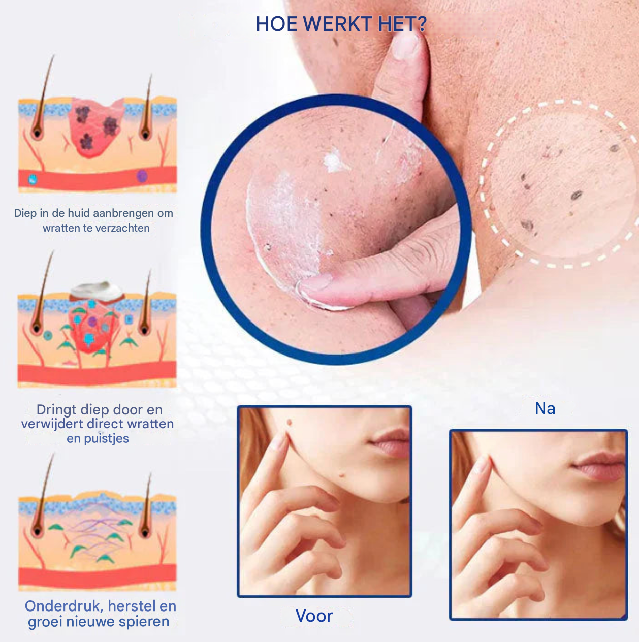 LS | Fast active wratverwijder crème