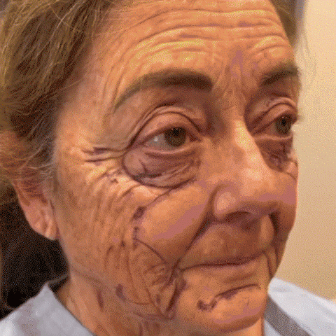 LS | 7-Daagse Bijengif Huidbehandeling 1+1 gratis