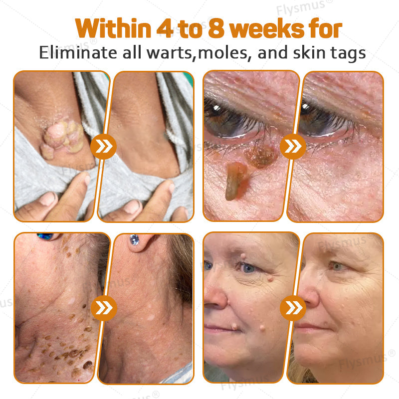 LS | Tag Recede Bijengif Behandelcrème