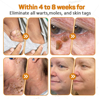 LS | Tag Recede Bijengif Behandelcrème