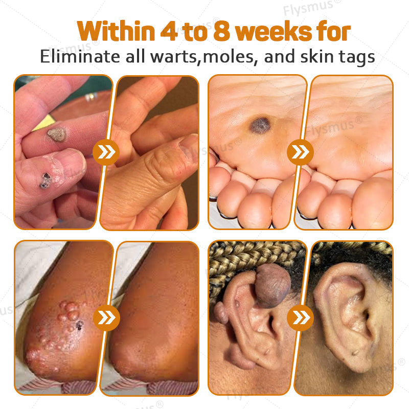 LS | Tag Recede Bijengif Behandelcrème