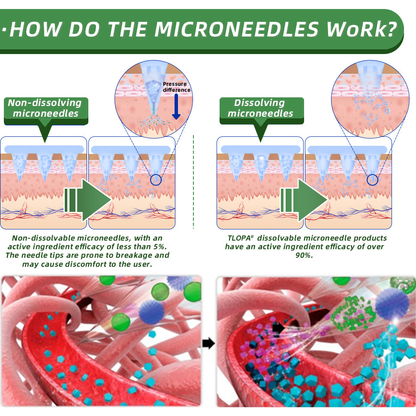 LS | Nano micro needling patch
