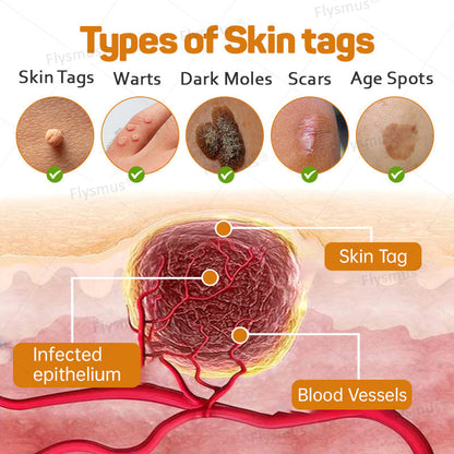 LS | Tag Recede Bijengif Behandelcrème