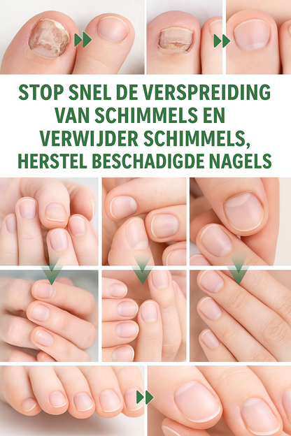 LS | Gember nagel behandeling