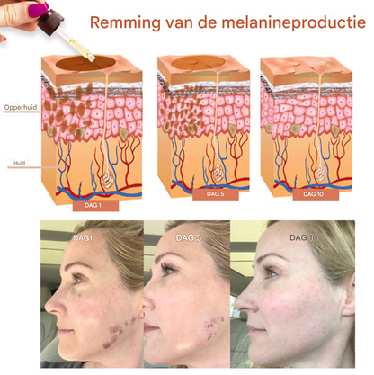 LS | Melanine huid corrigerende gezichtscreme