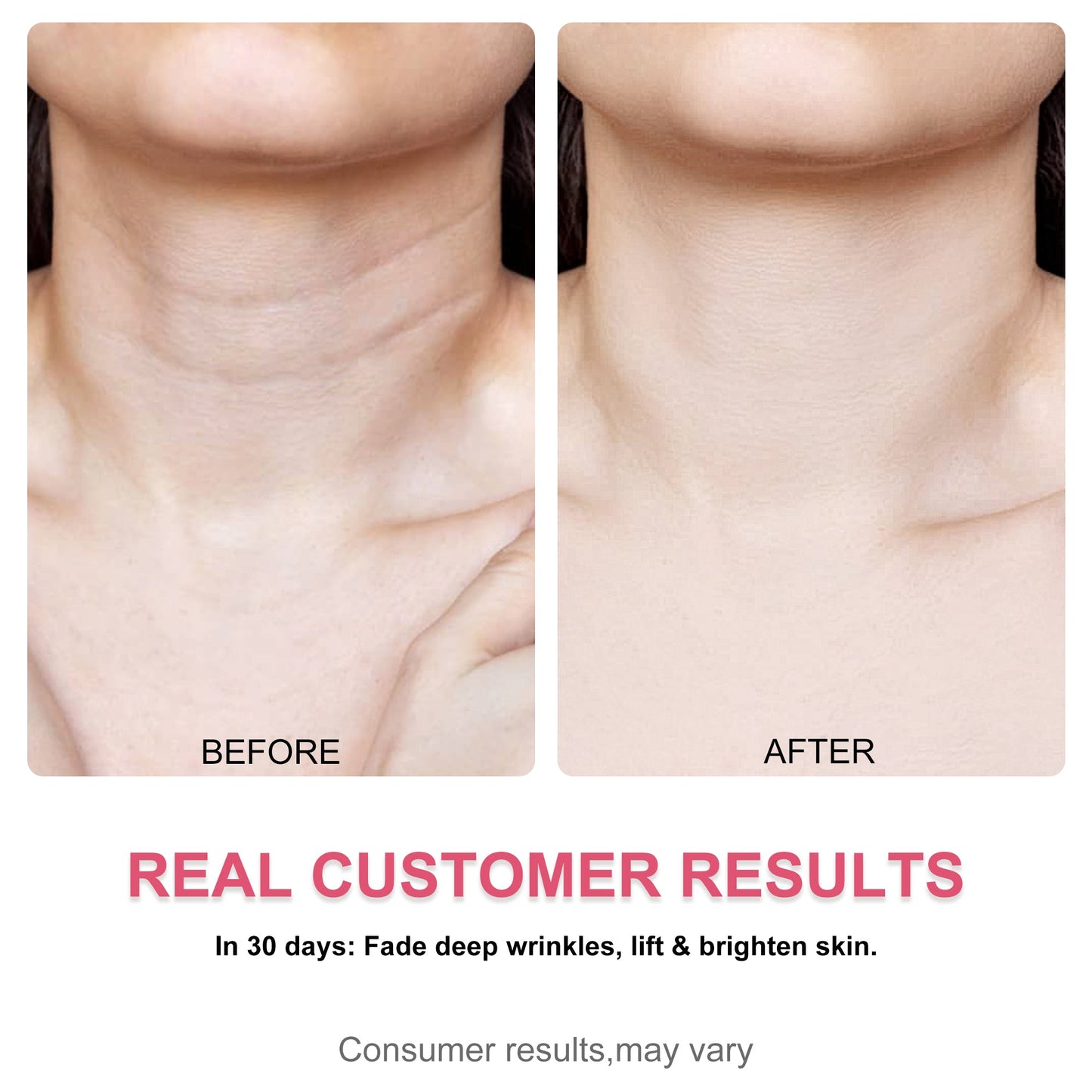 LS | Misoour Halsmasker Set: Collageen Peptide Anti-Rimpel Halsmasker