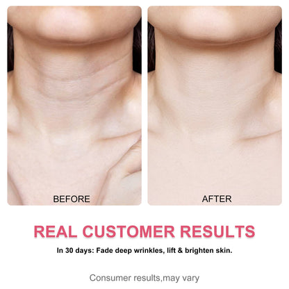 LS | Misoour Halsmasker Set: Collageen Peptide Anti-Rimpel Halsmasker