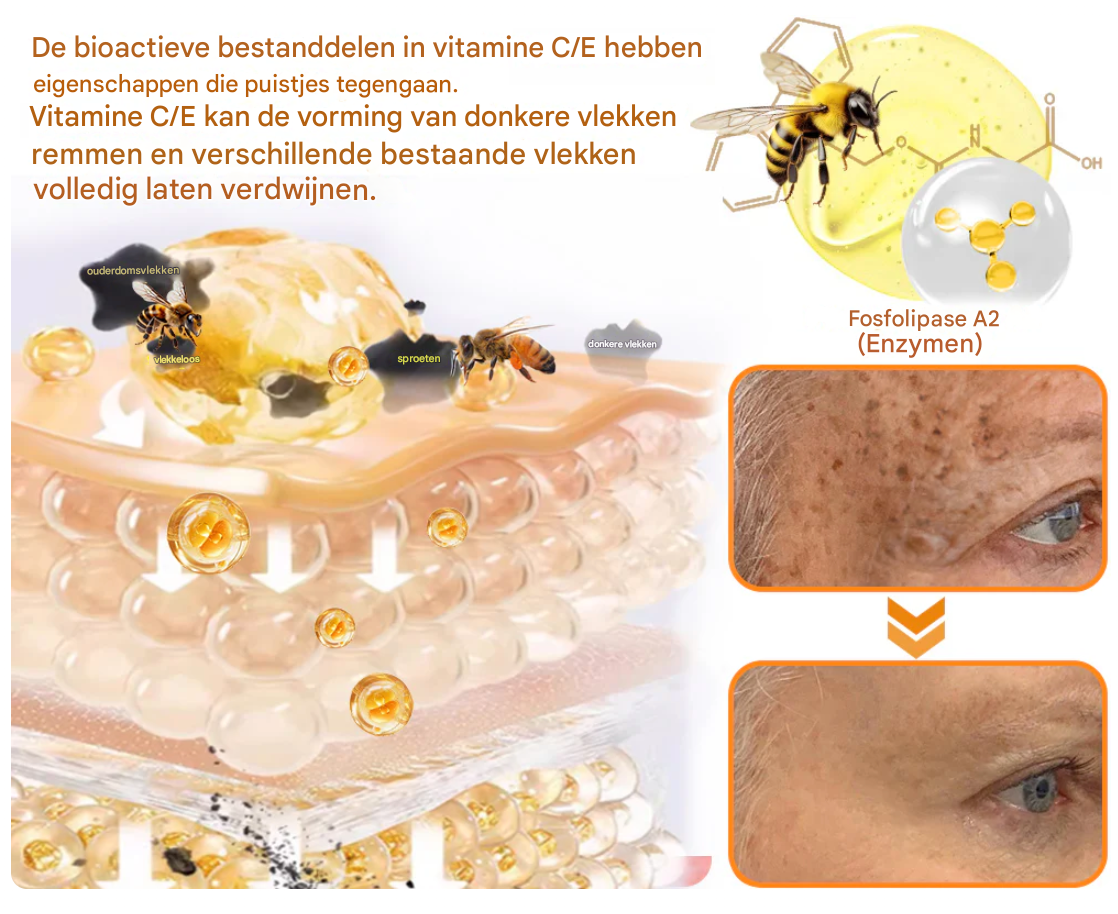 LS | 7-Daagse Bijengif Huidbehandeling 1+1 gratis