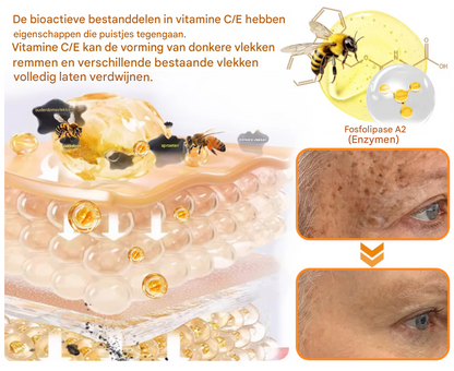 LS | 7-Daagse Bijengif Huidbehandeling 1+1 gratis