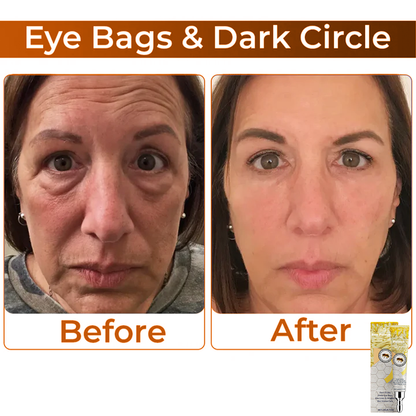 LS |  Collageen + Bijengif Oogcrème