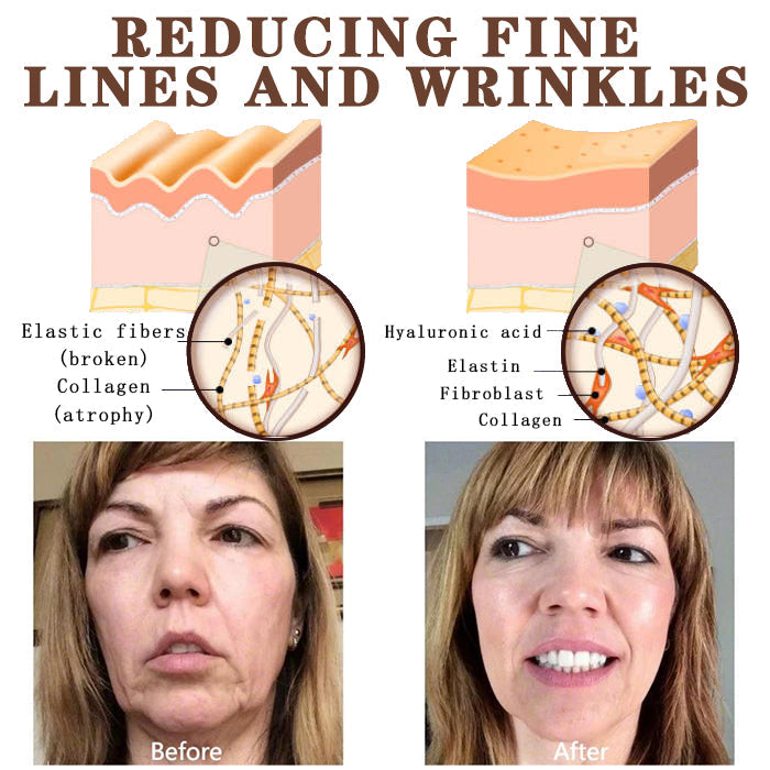 LS | Retinol anti-rimpel creme