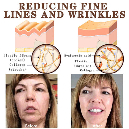 LS | Retinol anti-rimpel creme