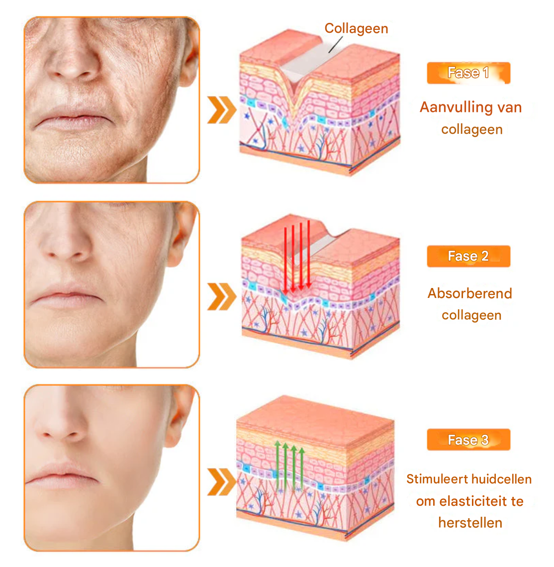 LS | 7-Daagse Bijengif Huidbehandeling 1+1 gratis
