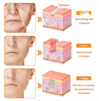 LS | 7-Daagse Bijengif Huidbehandeling 1+1 gratis