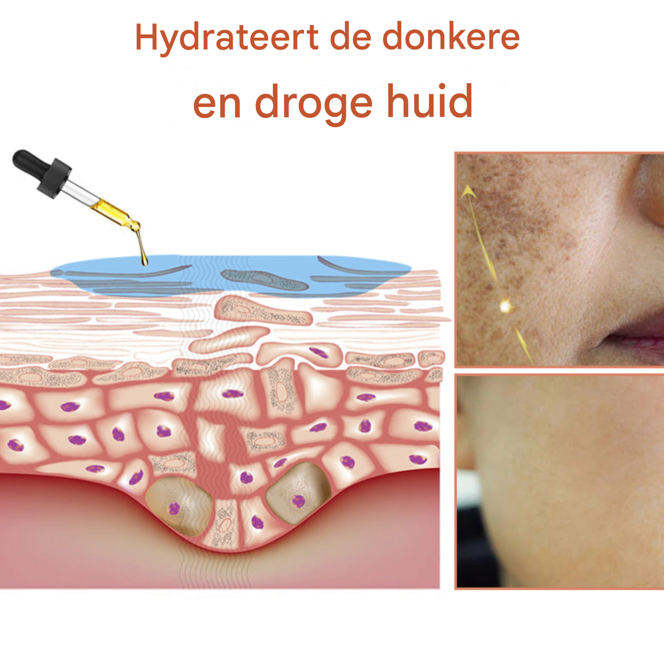 LS | Melanine huid corrigerende gezichtscreme