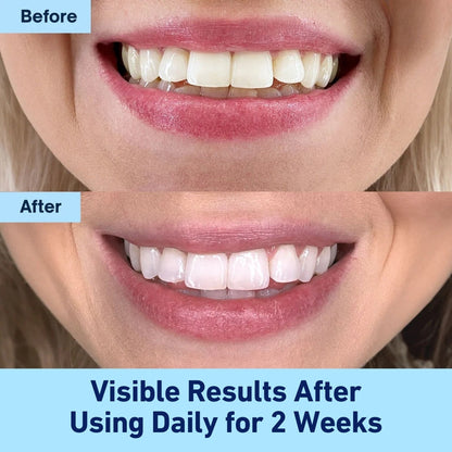 WinkWhite™ Teeth Whitening Powder
