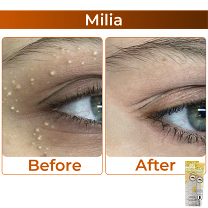 LS |  Collageen + Bijengif Oogcrème