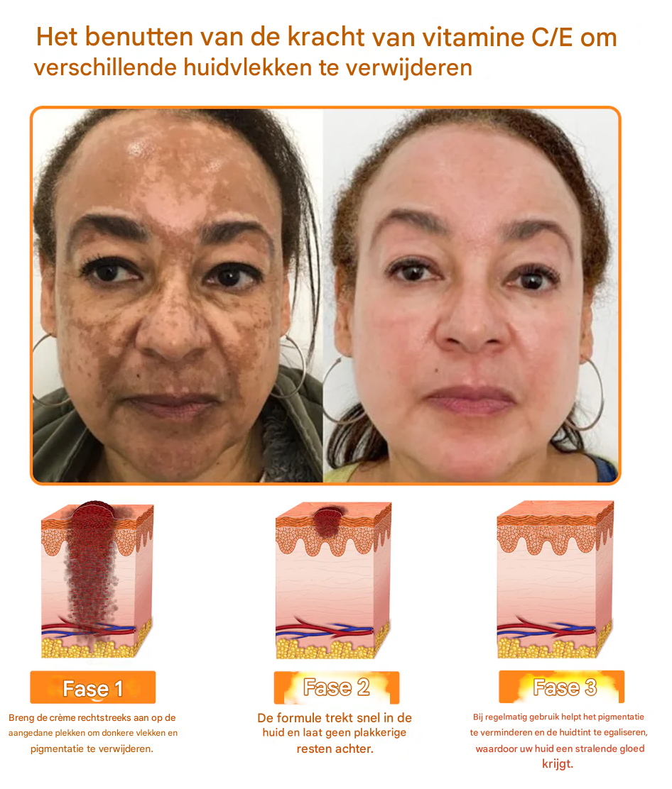 LS | 7-Daagse Bijengif Huidbehandeling 1+1 gratis