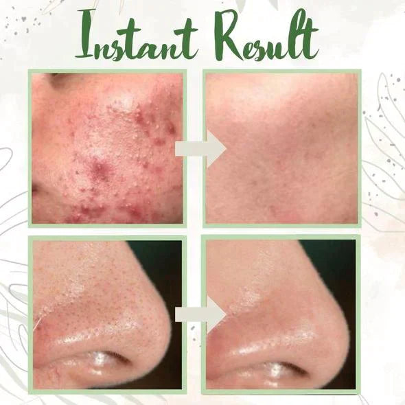 LS | Groene tee diep reinigende masker