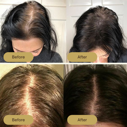 LS | Vegan haar groei olie