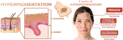 LS | Melanine huid corrigerende gezichtscreme