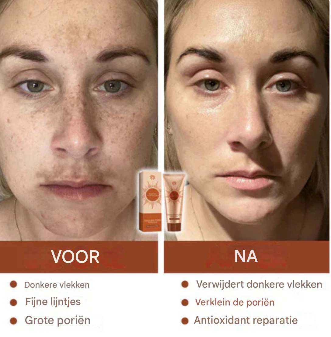 LS | Kruiden spot Peel off Masker