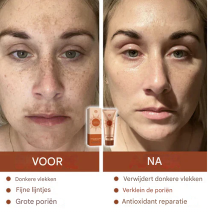 LS | Kruiden spot Peel off Masker