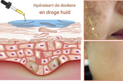LS | Melanine huid corrigerende gezichtscreme