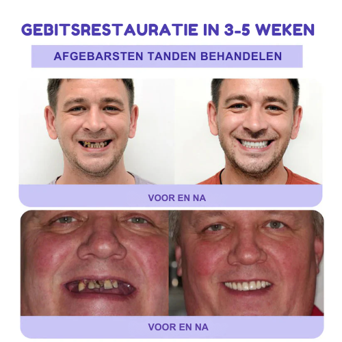 LS | Tanden Restauratie Mineraal Poeder