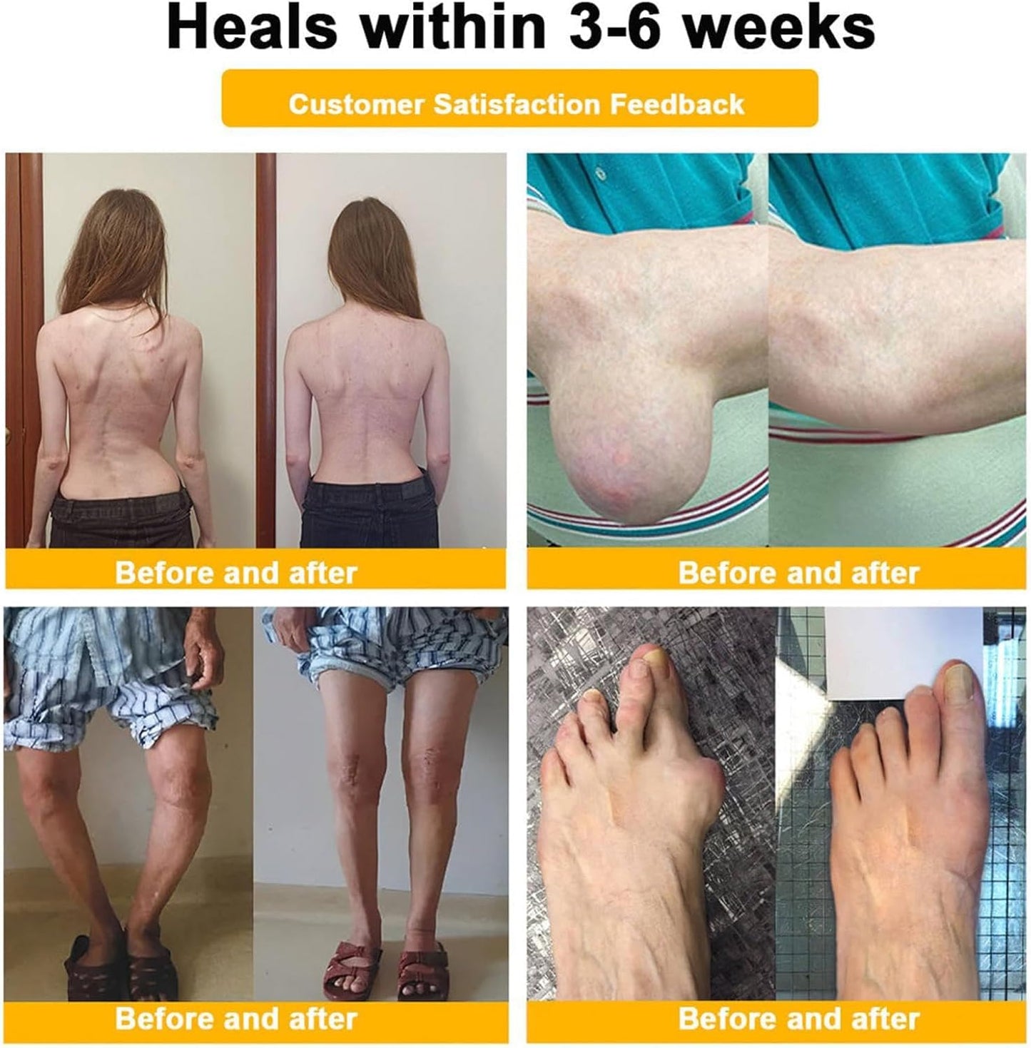 LS | Bijengif gewrichtherstel