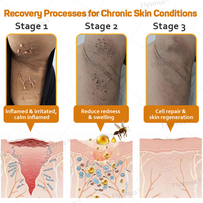LS | Tag Recede Bijengif Behandelcrème