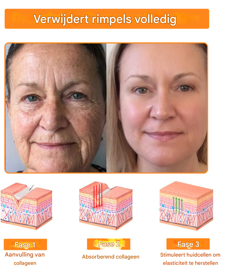 LS | 7-Daagse Bijengif Huidbehandeling 1+1 gratis