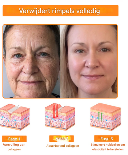 LS | 7-Daagse Bijengif Huidbehandeling 1+1 gratis