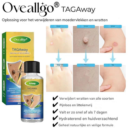 LS |  Moedervlekken & Wratten verwijderaar