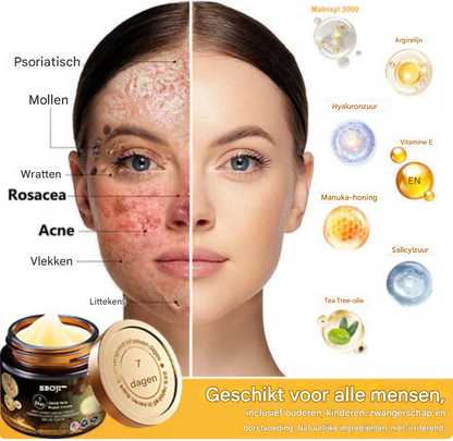 LS | 7-Daagse Bijengif Huidbehandeling 1+1 gratis