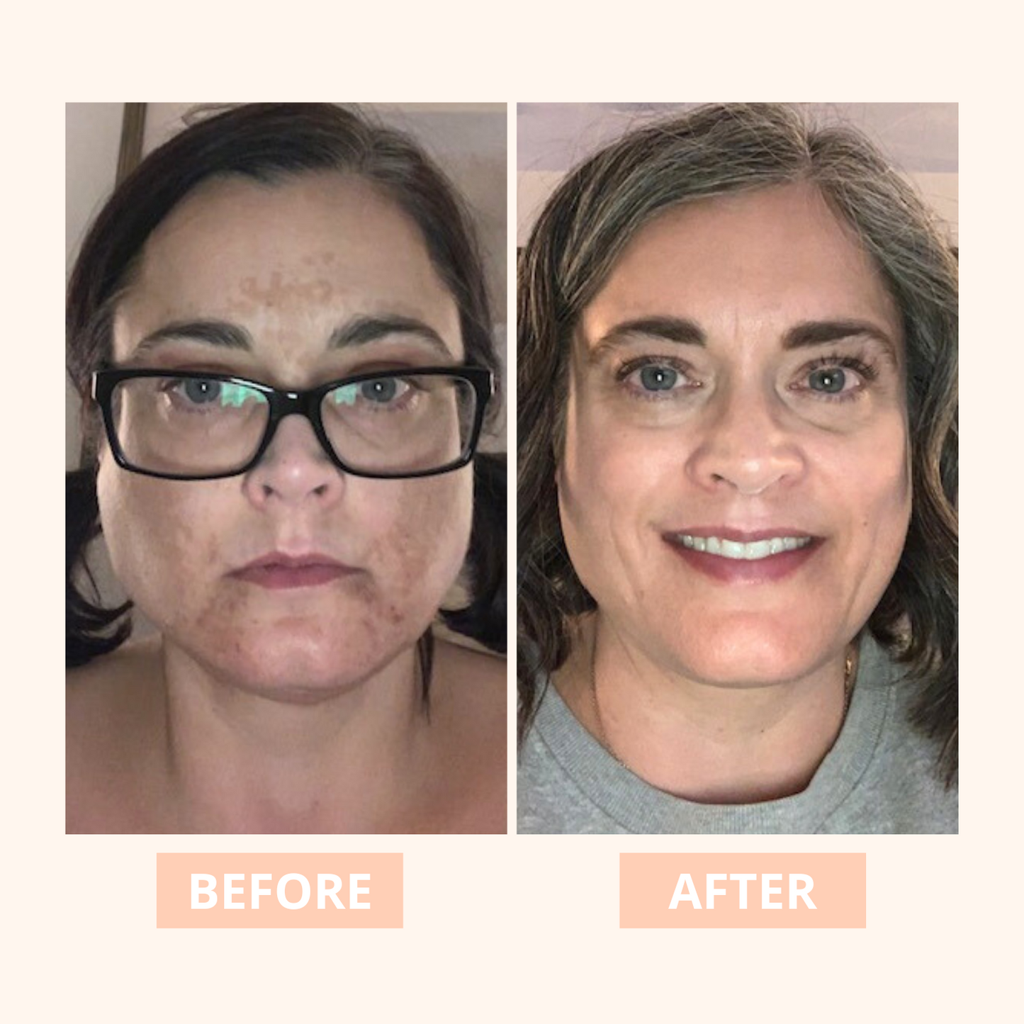 LS | Vitamine C Truly brightening