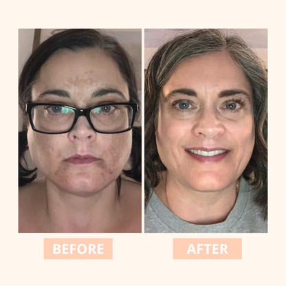 LS | Vitamine C Truly brightening