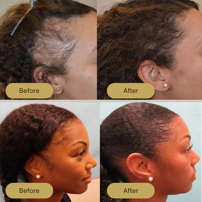 LS | Vegan haar groei olie