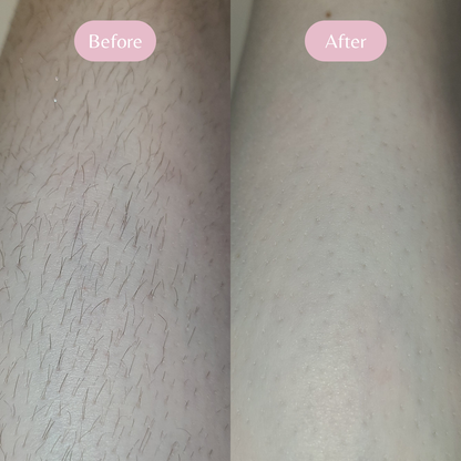 LS | Magic-touch Haar Verwijderaar