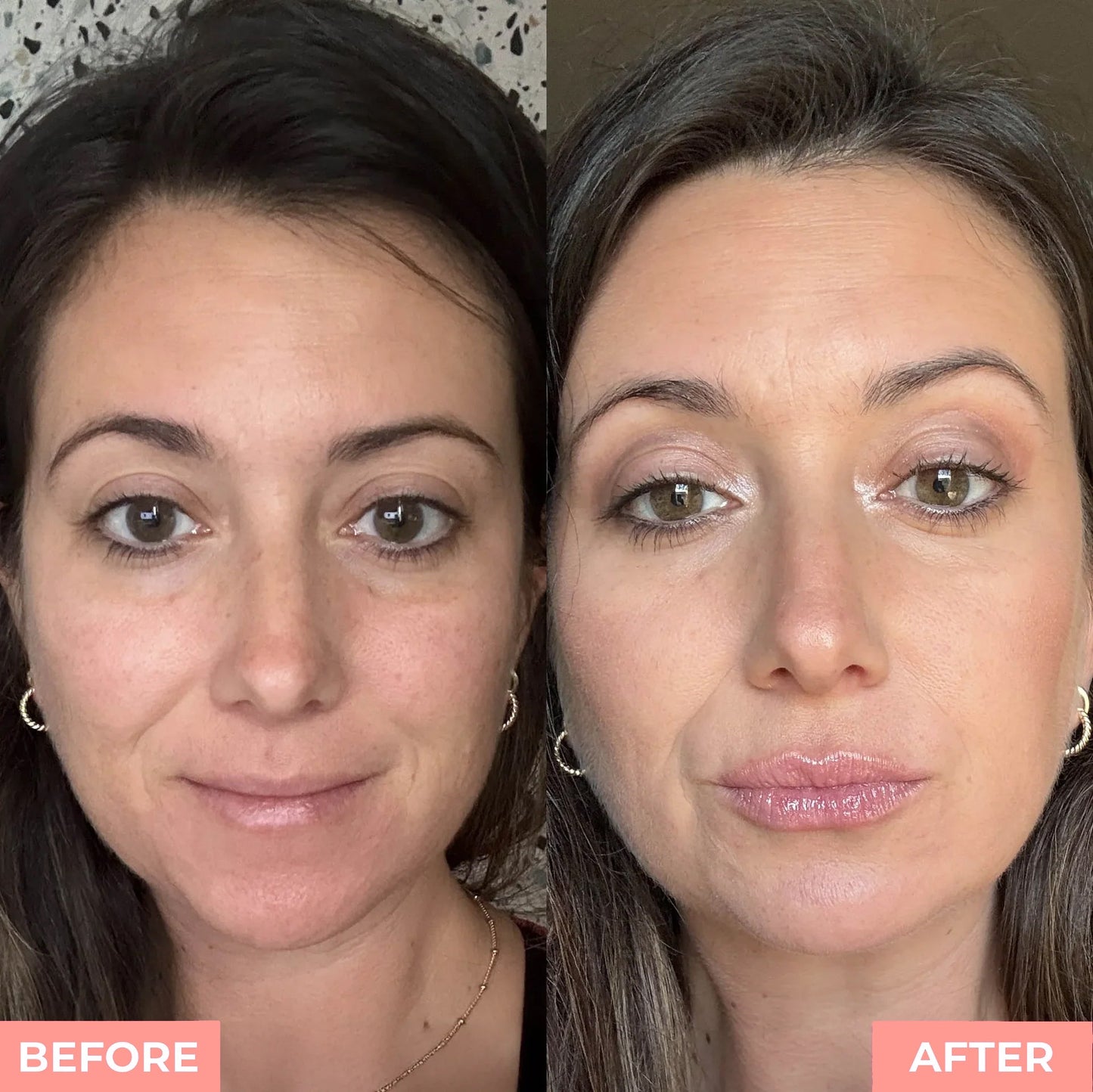 LS | Lippen plump kit