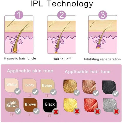 LS | IPL Laser Ontharing