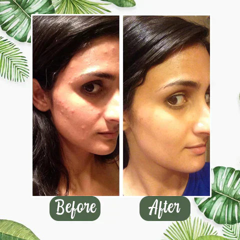 LS | Groene tee diep reinigende masker