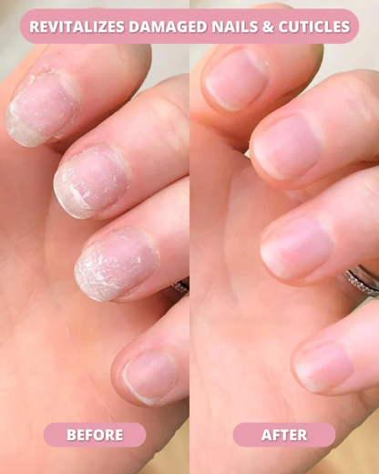 LS | Stamcel nagelgroei pen