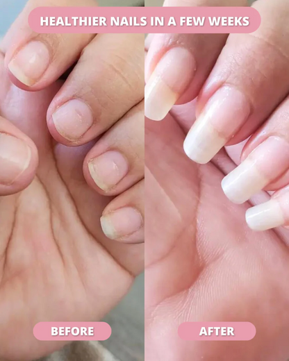 LS | Stamcel nagelgroei pen