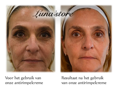 LS | Rimpelverwijdering creme 50% korting