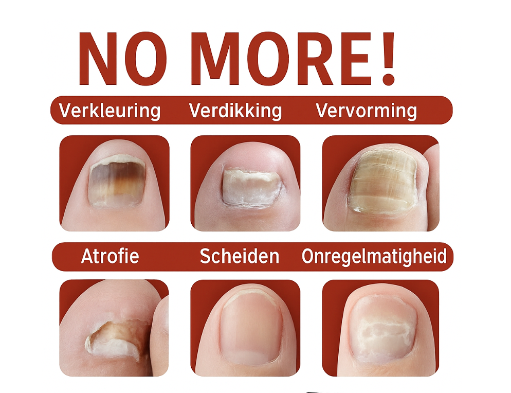 LS | Gember nagel behandeling
