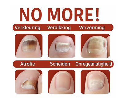LS | Gember nagel behandeling